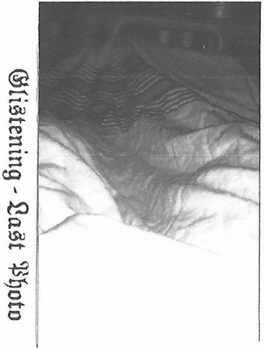 Glistening : Last Photo